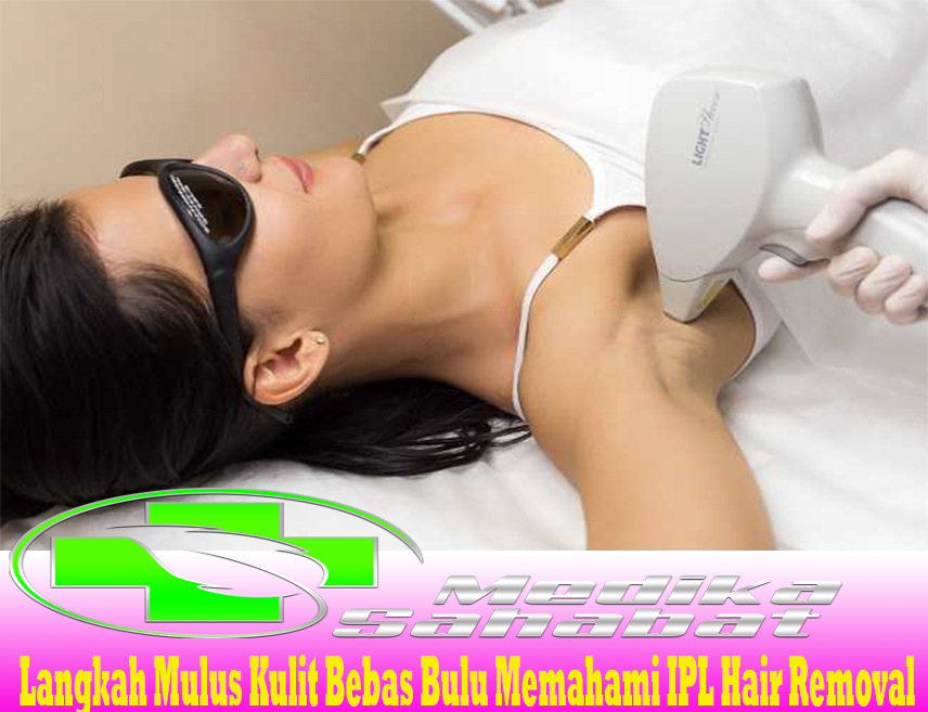 Langkah Mulus Kulit Bebas Bulu Memahami IPL Hair Removal