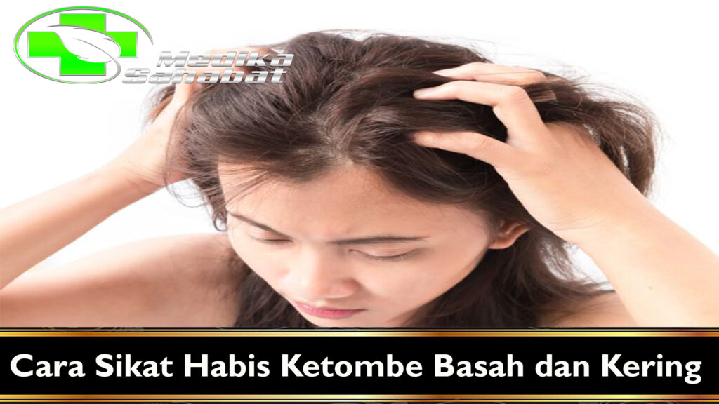 Cara Sikat Habis Ketombe Basah dan Kering