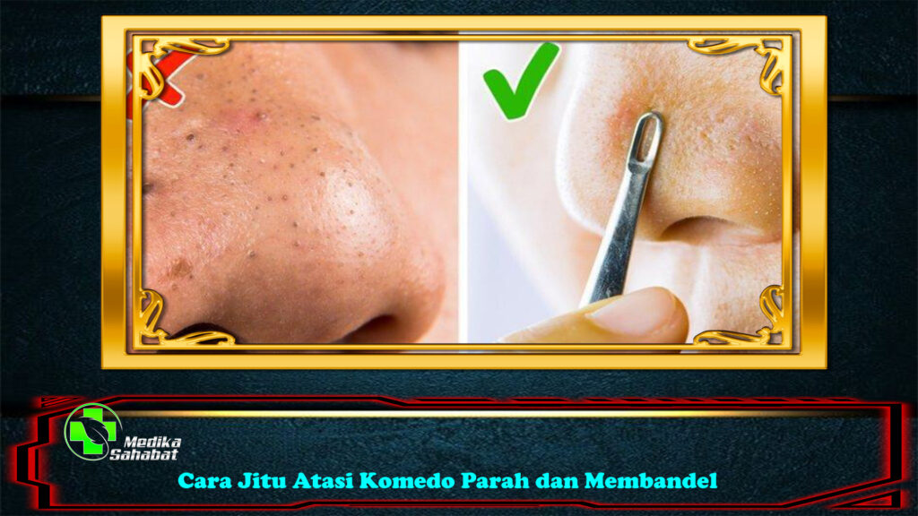Cara Jitu
