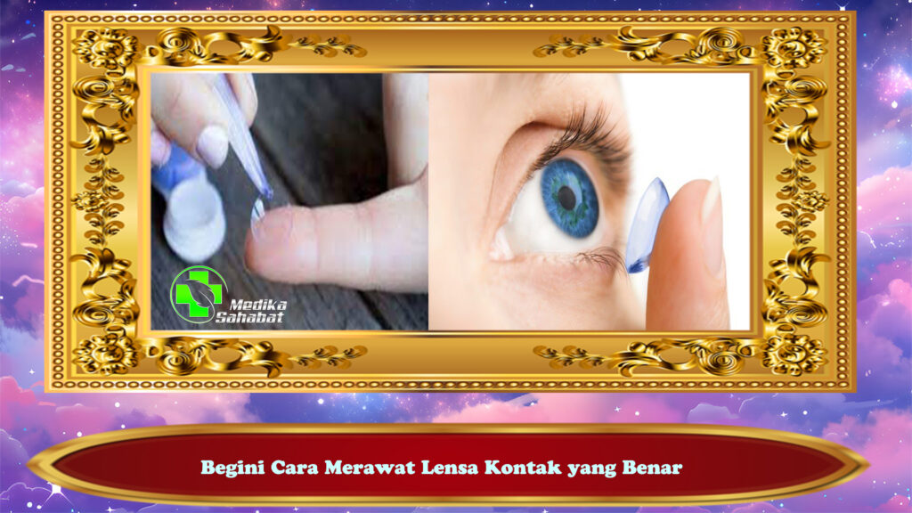 Begini Cara