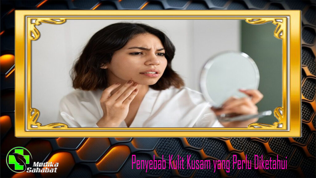 Penyebab Kulit Kusam yang Perlu Diketahui