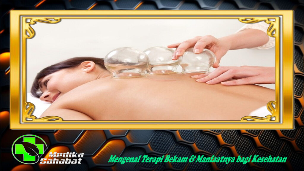 Mengenal Terapi Bekam & Manfaatnya bagi Kesehatan