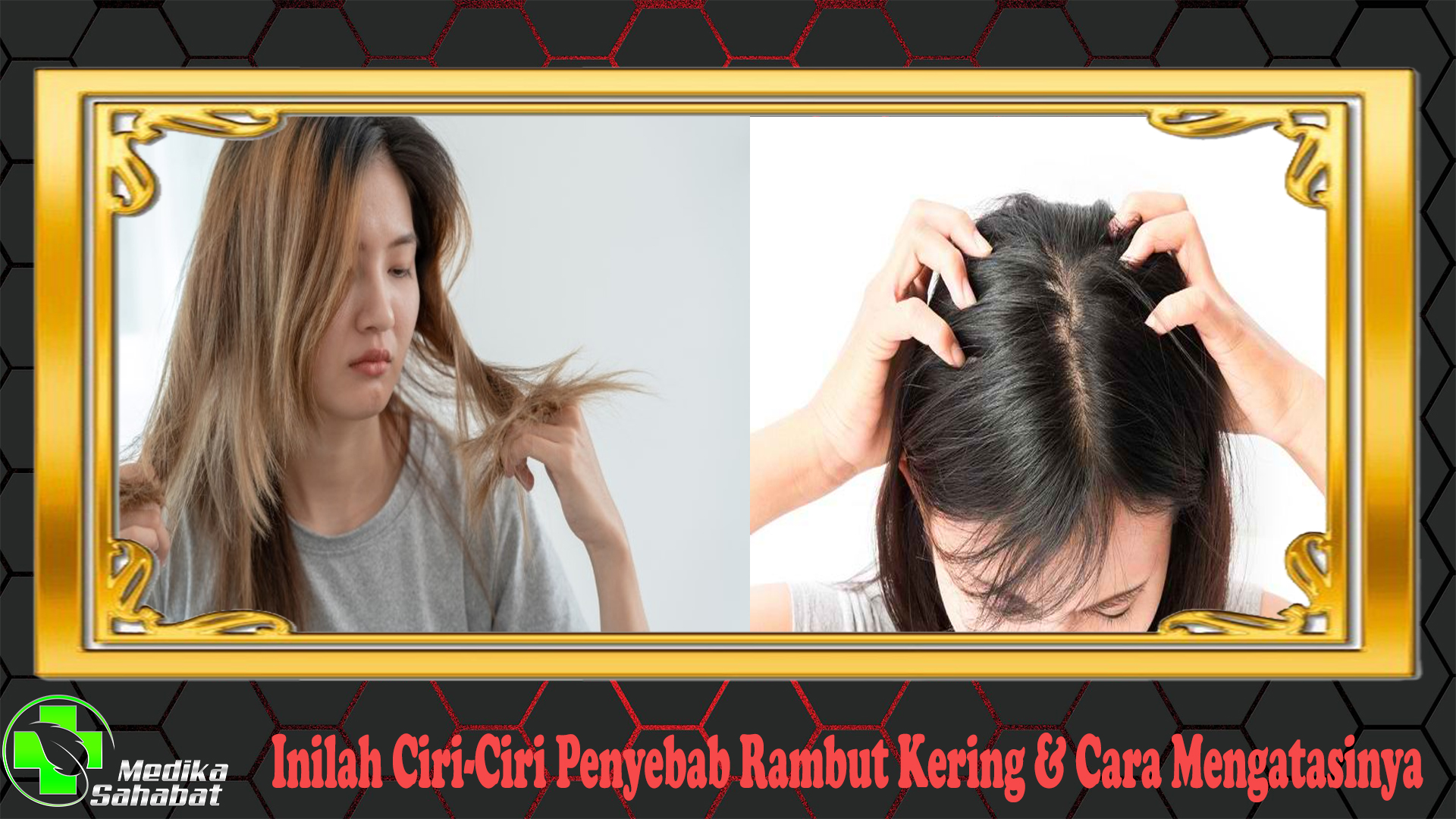 Inilah Ciri-Ciri Penyebab Rambut Kering & Cara Mengatasinya