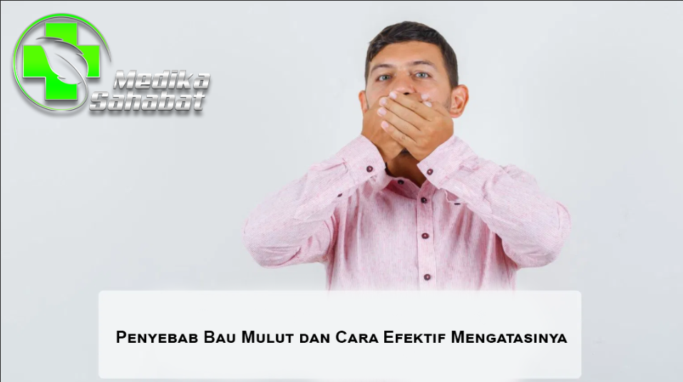 Penyebab Bau Mulut dan Cara Efektif Mengatasinya